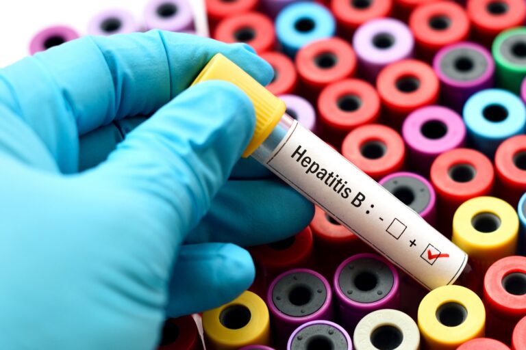 hepatitis-b